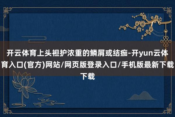 开云体育上头袒护浓重的鳞屑或结痂-开yun云体育入口(官方)网站/网页版登录入口/手机版最新下载